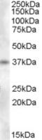 Proenkephalin-A antibody, TA303308, Origene, Western Blot image 