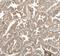Tryptase Delta 1 antibody, FNab08905, FineTest, Immunohistochemistry paraffin image 