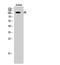 TAO Kinase 3 antibody, A08409, Boster Biological Technology, Western Blot image 