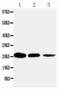 TNF Receptor Superfamily Member 1A antibody, PA5-80156, Invitrogen Antibodies, Western Blot image 