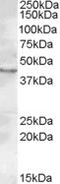 Cholinergic Receptor Nicotinic Beta 2 Subunit antibody, 46-942, ProSci, Western Blot image 