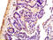 S100 Calcium Binding Protein A8 antibody, GTX60206, GeneTex, Immunohistochemistry paraffin image 