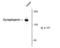 Synaptojanin 1 antibody, NBP1-47559, Novus Biologicals, Western Blot image 