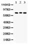 PKC beta-1 antibody, PA5-79868, Invitrogen Antibodies, Western Blot image 