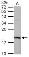 ARF7 antibody, GTX118495, GeneTex, Western Blot image 