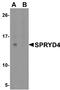 SPRY Domain Containing 4 antibody, A16685, Boster Biological Technology, Western Blot image 