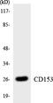 TNF Superfamily Member 8 antibody, LS-C291766, Lifespan Biosciences, Western Blot image 