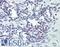 Phospholipase C Gamma 1 antibody, LS-B2311, Lifespan Biosciences, Immunohistochemistry frozen image 