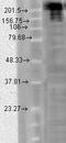 Sodium Voltage-Gated Channel Alpha Subunit 9 antibody, LS-C230765, Lifespan Biosciences, Western Blot image 