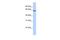 RNA Guanine-7 Methyltransferase antibody, PA5-41778, Invitrogen Antibodies, Western Blot image 