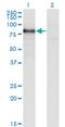 RNA Binding Motif Protein 5 antibody, H00010181-M02, Novus Biologicals, Western Blot image 