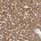 Semaphorin 3A antibody, NBP1-84409, Novus Biologicals, Immunohistochemistry paraffin image 