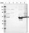 Galactose-1-Phosphate Uridylyltransferase antibody, PA5-52195, Invitrogen Antibodies, Western Blot image 