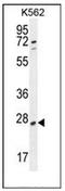 Phosphatase And Actin Regulator 1 antibody, AP52019PU-N, Origene, Western Blot image 
