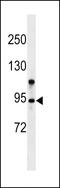 Zinc Finger MYM-Type Containing 6 antibody, 59-375, ProSci, Western Blot image 