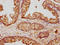 Annexin A5 antibody, LS-C369245, Lifespan Biosciences, Immunohistochemistry paraffin image 