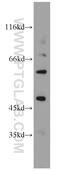 Potassium Voltage-Gated Channel Subfamily J Member 2 antibody, 19965-1-AP, Proteintech Group, Western Blot image 