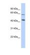 NAD Kinase 2, Mitochondrial antibody, NBP1-56734, Novus Biologicals, Western Blot image 