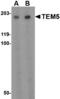 Adhesion G Protein-Coupled Receptor A2 antibody, MBS150720, MyBioSource, Western Blot image 