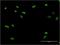 Zinc Finger Protein 287 antibody, H00057336-M11, Novus Biologicals, Immunocytochemistry image 