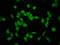 SNF2 Histone Linker PHD RING Helicase antibody, LS-C673001, Lifespan Biosciences, Immunofluorescence image 
