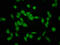 E3 ubiquitin-protein ligase SHPRH antibody, LS-C673001, Lifespan Biosciences, Immunofluorescence image 