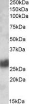 Thy-1 Cell Surface Antigen antibody, TA305663, Origene, Western Blot image 
