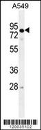 RAD17 Checkpoint Clamp Loader Component antibody, 55-996, ProSci, Western Blot image 