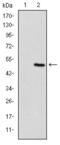 Troponin I2, Fast Skeletal Type antibody, M07355, Boster Biological Technology, Western Blot image 