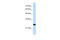 Transmembrane Protein 109 antibody, 30-546, ProSci, Enzyme Linked Immunosorbent Assay image 