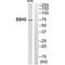 Slingshot Protein Phosphatase 3 antibody, PA5-50097, Invitrogen Antibodies, Western Blot image 