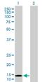 NADH:Ubiquinone Oxidoreductase Subunit B6 antibody, H00004712-D01P, Novus Biologicals, Western Blot image 