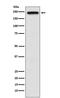 Transient Receptor Potential Cation Channel Subfamily M Member 7 antibody, M00789, Boster Biological Technology, Western Blot image 