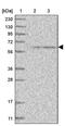 FERM, ARH/RhoGEF And Pleckstrin Domain Protein 2 antibody, PA5-56681, Invitrogen Antibodies, Western Blot image 