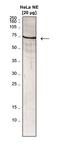 Mediator Complex Subunit 26 antibody, CI1092, Boster Biological Technology, Western Blot image 