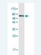 Cadherin 11 antibody, H00001009-M08-100ug, Novus Biologicals, Western Blot image 