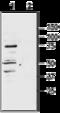 Melanocortin 1 Receptor antibody, GTX03405, GeneTex, Western Blot image 