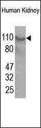 USO1 Vesicle Transport Factor antibody, 251923, Abbiotec, Western Blot image 