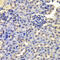 LSM4 antibody, 19-925, ProSci, Immunohistochemistry paraffin image 