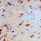 NFKB Inhibitor Beta antibody, LS-C352569, Lifespan Biosciences, Immunohistochemistry paraffin image 