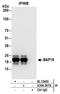 Chromosome 17 Open Reading Frame 49 antibody, A304-207A, Bethyl Labs, Immunoprecipitation image 