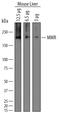 Mannose Receptor C-Type 1 antibody, PA5-46994, Invitrogen Antibodies, Western Blot image 
