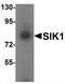 Salt Inducible Kinase 1 antibody, TA320117, Origene, Western Blot image 
