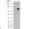 B-Raf Proto-Oncogene, Serine/Threonine Kinase antibody, LS-C812837, Lifespan Biosciences, Western Blot image 