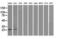 Neurogenin 1 antibody, GTX84051, GeneTex, Western Blot image 