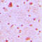 Aryl Hydrocarbon Receptor Nuclear Translocator 2 antibody, LS-C354133, Lifespan Biosciences, Immunohistochemistry paraffin image 