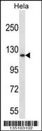 DNA Methyltransferase 3 Alpha antibody, 57-872, ProSci, Western Blot image 