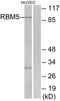 RNA Binding Motif Protein 5 antibody, LS-C118933, Lifespan Biosciences, Western Blot image 