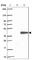 Exosome Component 8 antibody, HPA039702, Atlas Antibodies, Western Blot image 