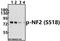 Neurofibromin 2 antibody, A00279S518, Boster Biological Technology, Western Blot image 